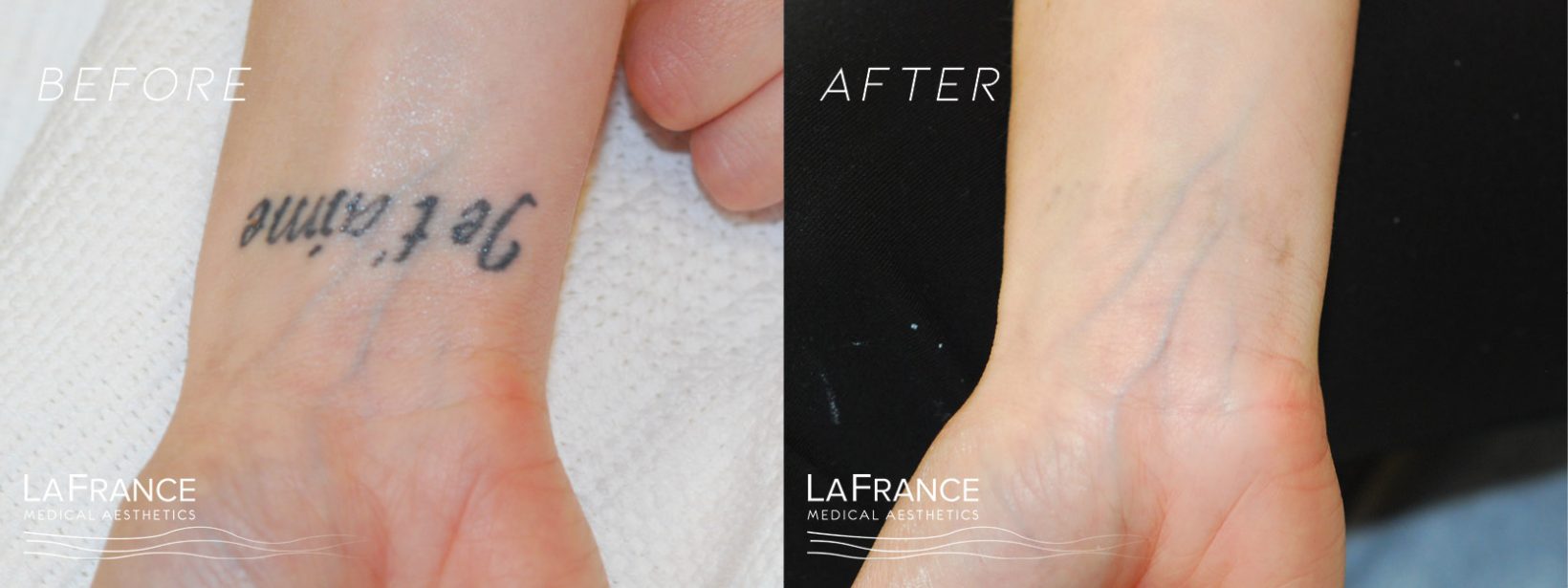LFMB&A2 LaFrance Medical Aesthetics Clinic In
